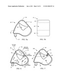 Airbag system diagram and image