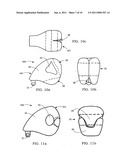 Airbag system diagram and image