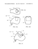 Airbag system diagram and image