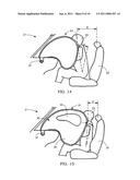 Airbag system diagram and image