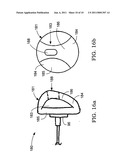 Airbag system diagram and image