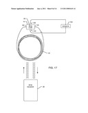 MINIATURE HERMETICALLY SEALED RFID MICROELECTRONIC CHIP CONNECTED TO A BIOCOMPATIBLE RFID ANTENNA FOR USE IN CONJUNCTION WITH AN AIMD diagram and image