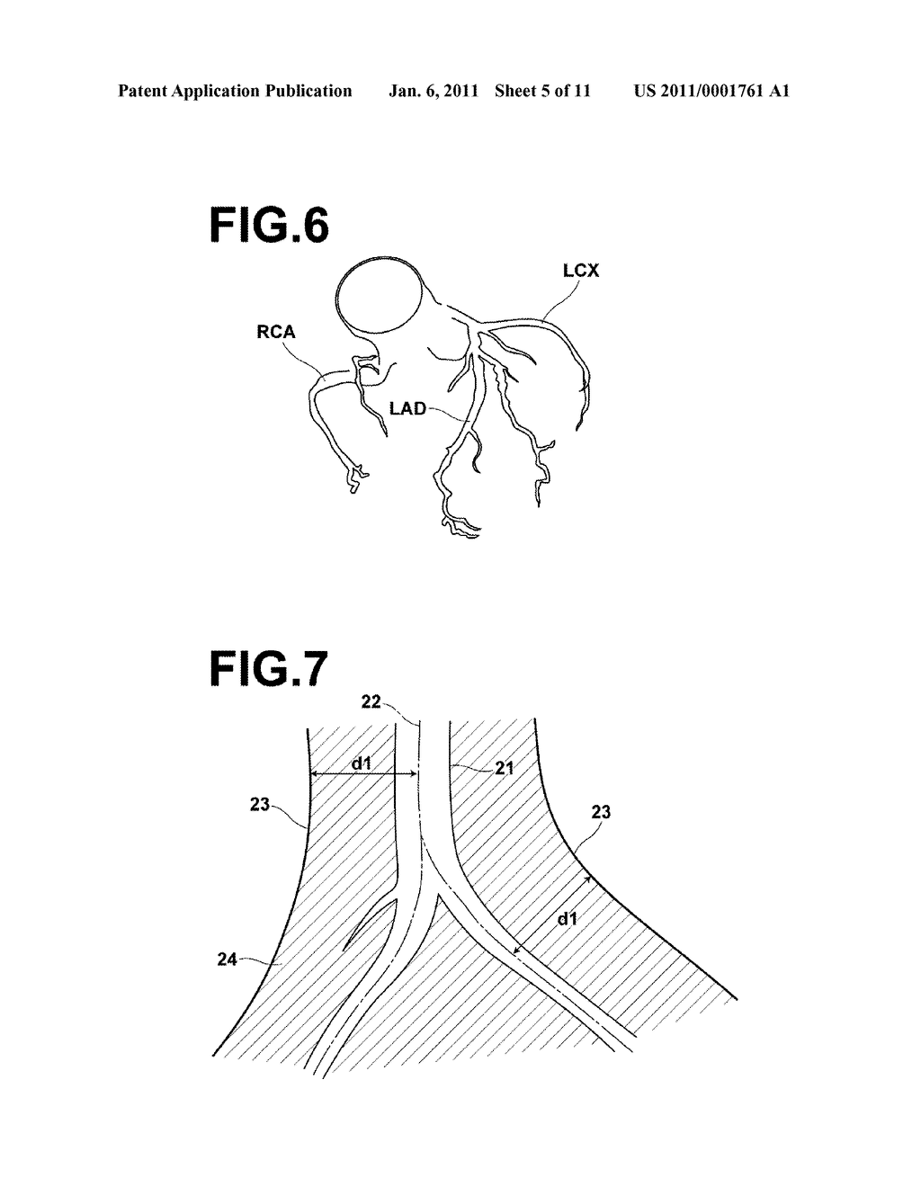 DIAGNOSIS ASSISTING APPARATUS, DIAGNOSIS ASSISTING METHOD, AND STORAGE MEDIUM IN WHICH A DIAGNOSIS ASSISTING PROGRAM IS RECORDED - diagram, schematic, and image 06