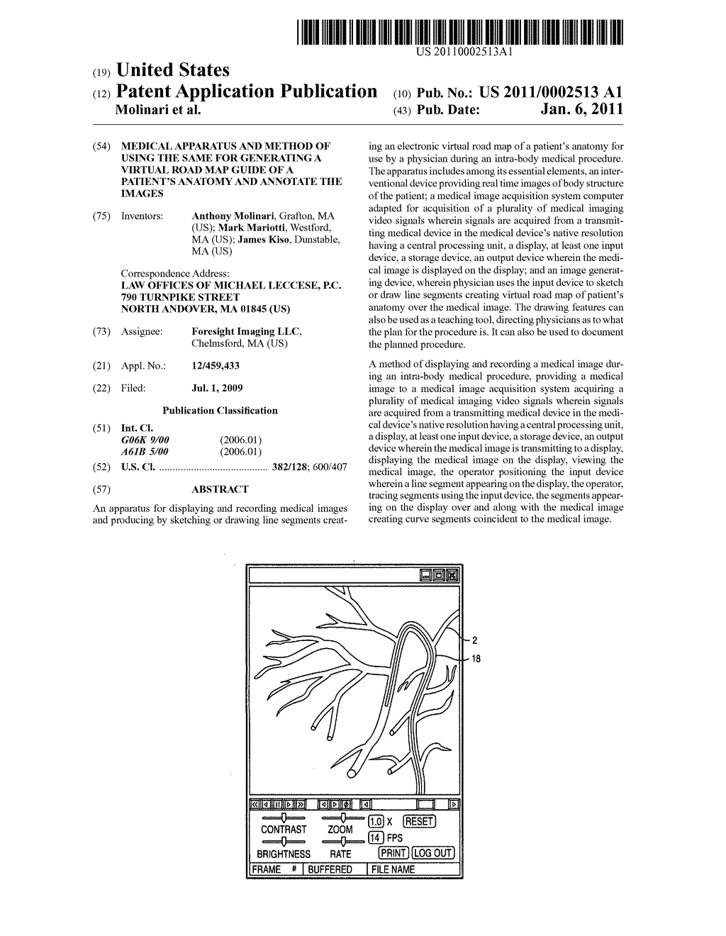 Medical apparatus and method of using the same for generating a virtual road map guide of a patient's anatomy and annotate the images - diagram, schematic, and image 01