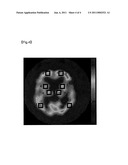 CEREBRAL BLOOD FLOW QUANTIFICATION DEVICE, CEREBRAL BLOOD FLOW QUANTIFICATION METHOD AND PROGRAM diagram and image