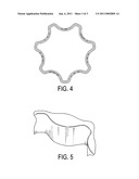 FORMABLE SINTERED ALLOY WITH DISPERSED HARD PHASE diagram and image