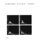 COMPOSITION FOR AUTOTRANSPLANTATION OR ALLOTRANSPLANTATION USING DENTAL PULP STEM CELL, AND USE OF THE COMPOSITION diagram and image