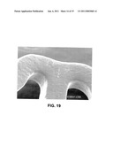 Thermal Treatment Of An Implantable Medical Device diagram and image