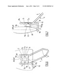 TWEEZERS FOR ORTHODONTIC LOCK diagram and image