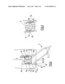 TWEEZERS FOR ORTHODONTIC LOCK diagram and image