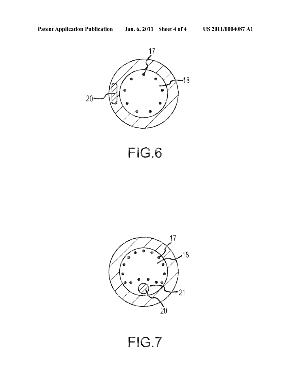 Apparatus and Methods for Contactless Electrophysiology Studies - diagram, schematic, and image 05