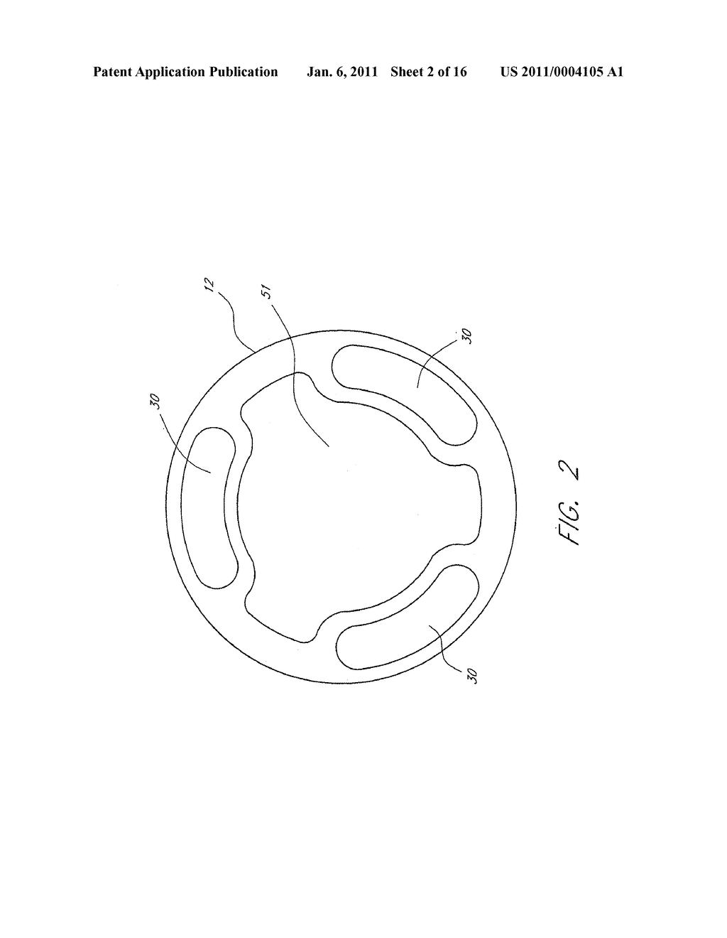 POWER PARAMETERS FOR ULTRASONIC CATHETER - diagram, schematic, and image 03