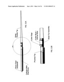 ATHERECTOMY CATHETER WITH LATERALLY-DISPLACEABLE TIP diagram and image