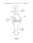 Orthotic brace diagram and image