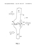 Orthotic brace diagram and image