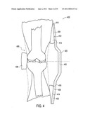 Orthotic brace diagram and image