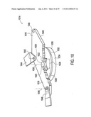 Orthotic brace diagram and image