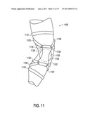 Orthotic brace diagram and image