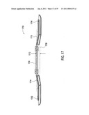 Orthotic brace diagram and image