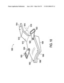 Orthotic brace diagram and image