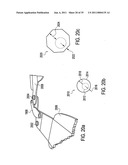 Orthotic brace diagram and image