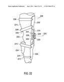 Orthotic brace diagram and image