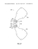 Orthotic brace diagram and image