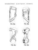 Orthotic brace diagram and image