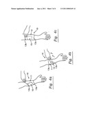 Preparation and Use of Sleeve and Micro-Encapsulated Topical Analgesic Patch For Treating Pain diagram and image