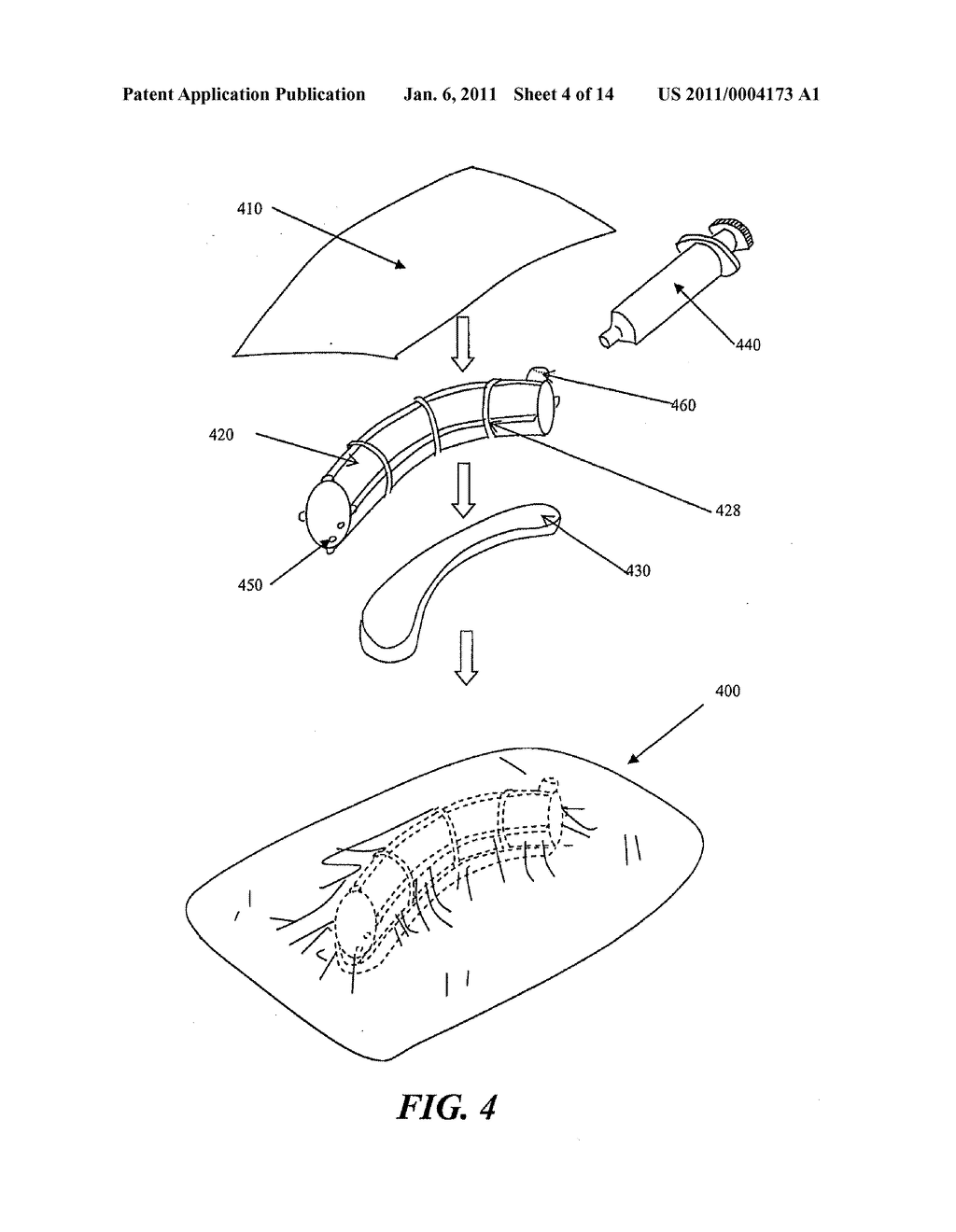 Closed Incision Negative Pressure Wound Therapy Device and Methods of Use - diagram, schematic, and image 05