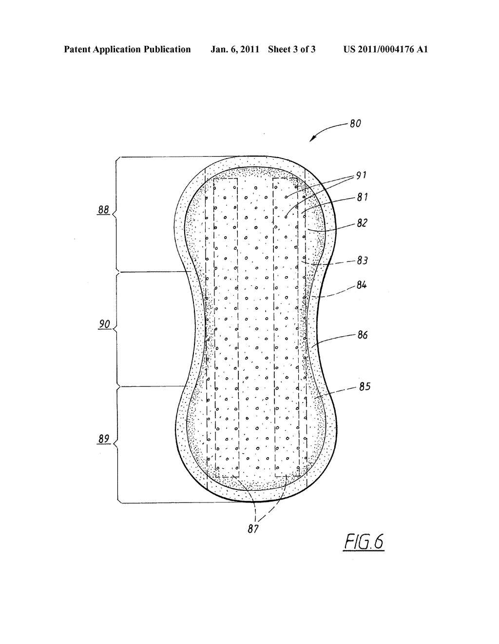 MATERIAL WEB FOR USE IN AN ABSORBENT ARTICLE - diagram, schematic, and image 04