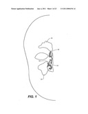 DEVICE AND METHODS FOR TREATING PARANASAL SINUS CONDITIONS diagram and image