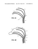 DEVICE AND METHODS FOR TREATING PARANASAL SINUS CONDITIONS diagram and image