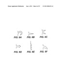 DEVICE AND METHODS FOR TREATING PARANASAL SINUS CONDITIONS diagram and image