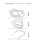 DEVICE AND METHODS FOR TREATING PARANASAL SINUS CONDITIONS diagram and image