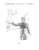 Pressure Sensing Catheter diagram and image