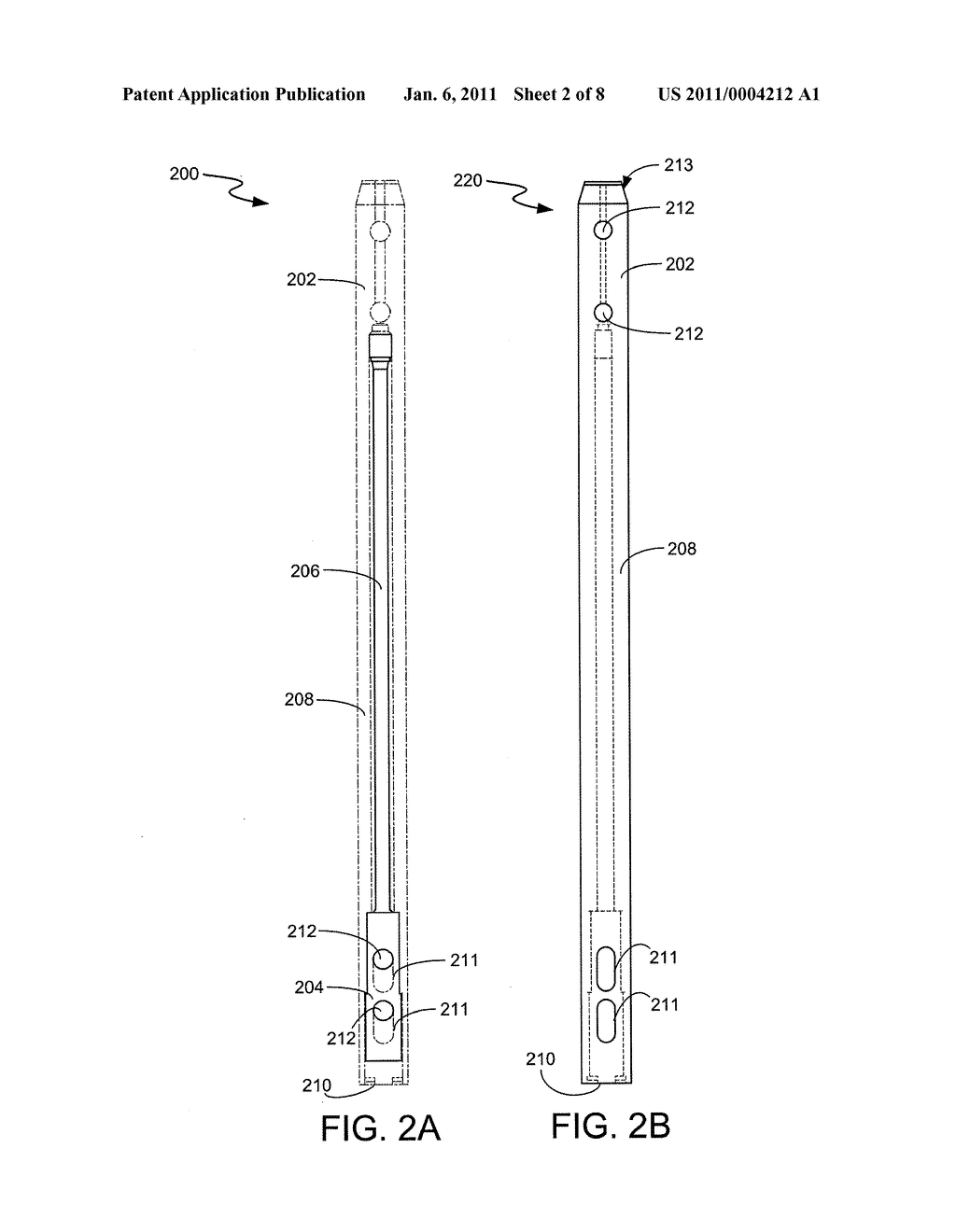 INTRAMEDULLARY MEDICAL DEVICE AND METHODS OF USE AND MANUFACTURE - diagram, schematic, and image 03