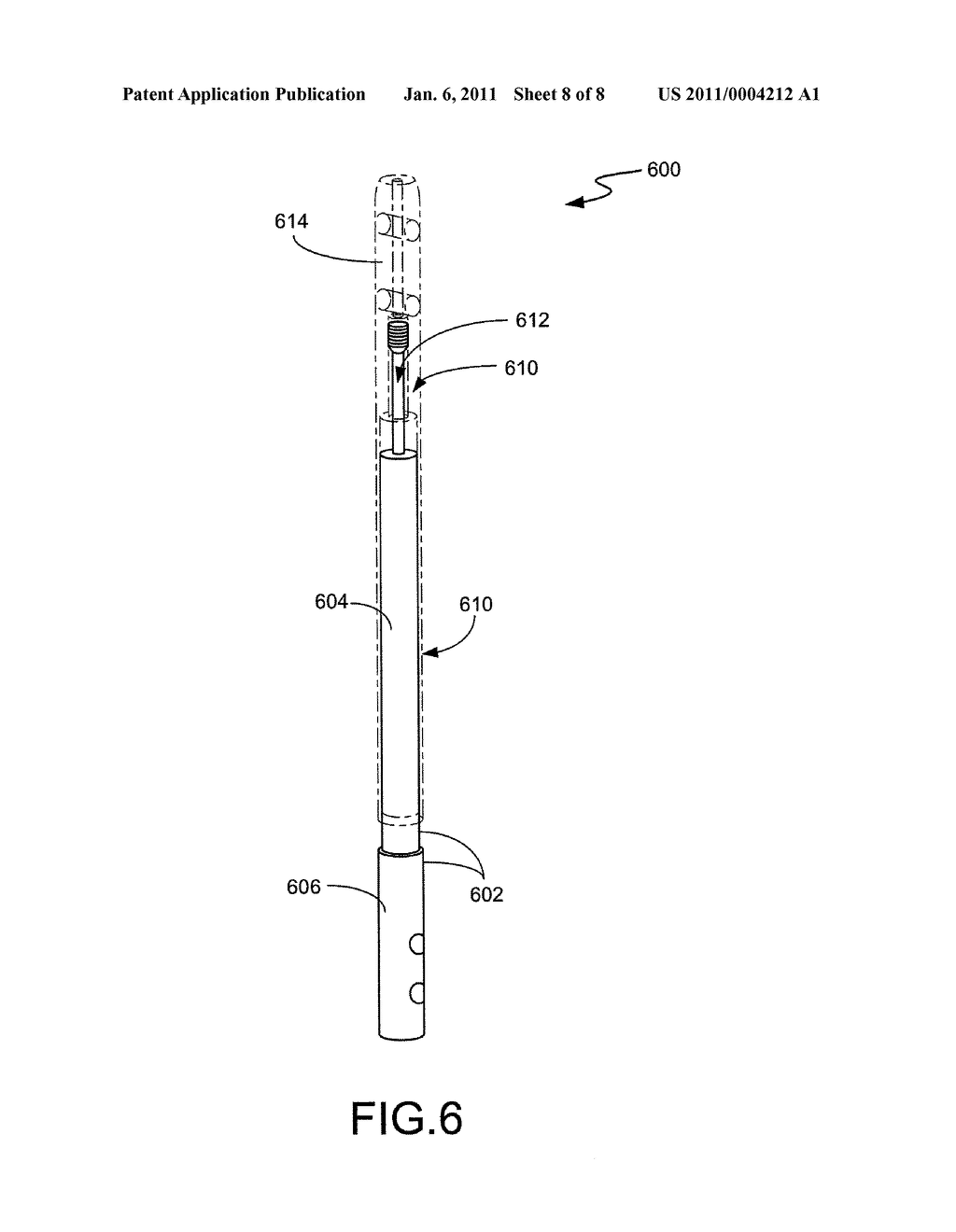 INTRAMEDULLARY MEDICAL DEVICE AND METHODS OF USE AND MANUFACTURE - diagram, schematic, and image 09