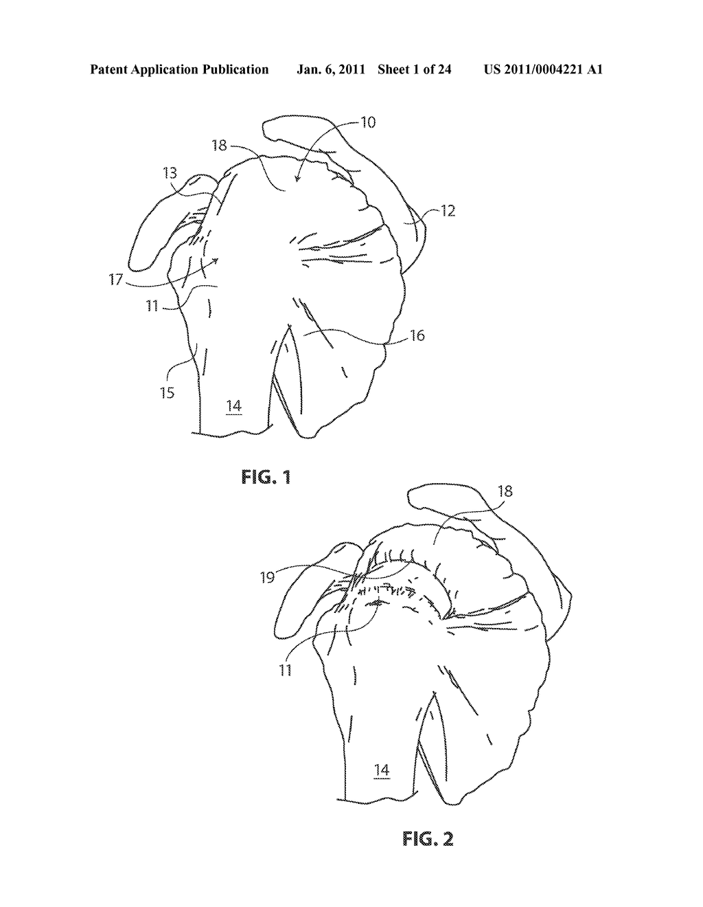 METHODS AND APPARATUS FOR DEPLOYING SHEET-LIKE MATERIALS - diagram, schematic, and image 02