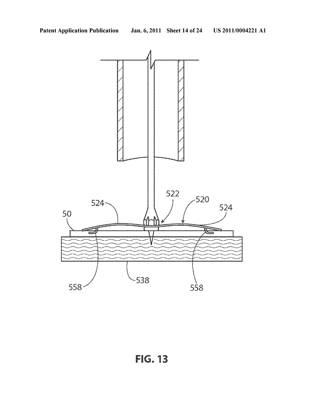 METHODS AND APPARATUS FOR DEPLOYING SHEET-LIKE MATERIALS - diagram, schematic, and image 15