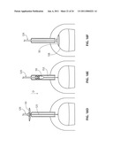 METHODS AND APPARATUS FOR DEPLOYING SHEET-LIKE MATERIALS diagram and image