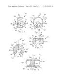 VALVES AND HUBS FOR TUBULAR DEVICES AND METHODS FOR MAKING AND USING THEM diagram and image