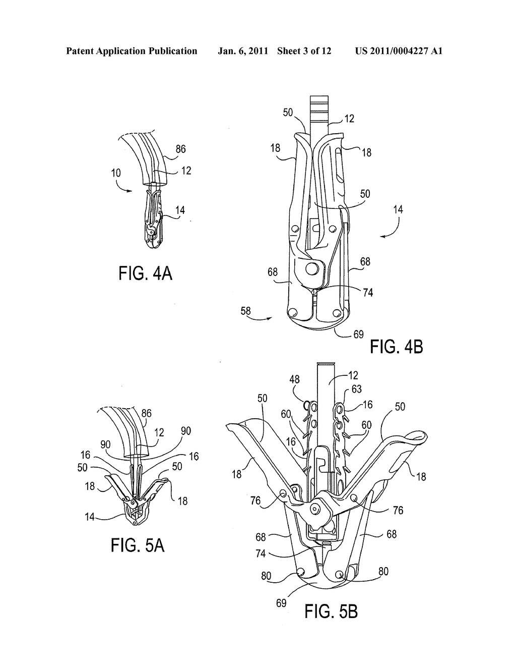 FIXATION DEVICES FOR VARIATION IN ENGAGEMENT OF TISSUE - diagram, schematic, and image 04
