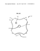 Systems and Methods for Treating Obesity and Type 2 Diabetes diagram and image