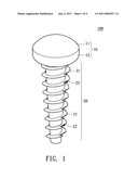 Implant Structure diagram and image