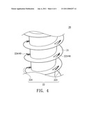 Implant Structure diagram and image