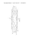 Bifurcated Stent and Delivery System diagram and image