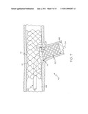 Bifurcated Stent and Delivery System diagram and image