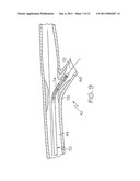 Bifurcated Stent and Delivery System diagram and image