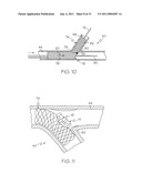 Bifurcated Stent and Delivery System diagram and image